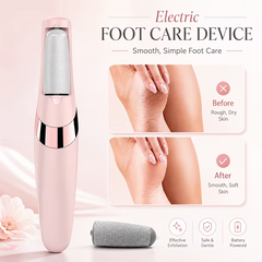 TM-0104 | Portable Foot Care Device with Grinding Heads