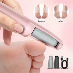 Electric Foot Callus Remover – Rechargeable Pedicure Tool with Speed Control