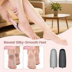 Electric Foot Callus Remover – Rechargeable Pedicure Tool with Speed Control